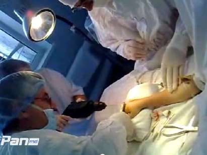 Скандално видео се появи в YouTube, лекари дупчат деца с дрелки  (ВИДЕО)