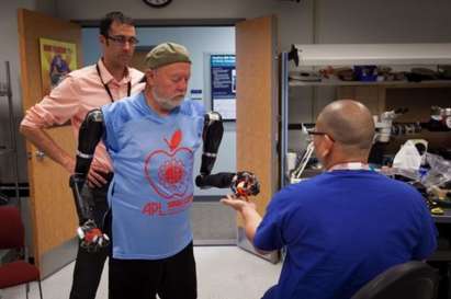 Мъж, загубил ръцете си преди 40 години, се сдоби с роботизирани крайници