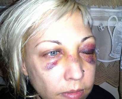 Полицаят, обвинен за боя на жената в метрото - не съм я бил, тя ме душеше