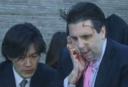 Нападнаха с бръснач американския посланик в Южна Корея