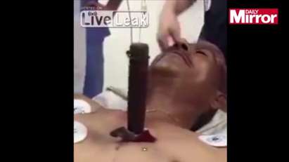 Мъж със забит огромен нож в гърдите говори с лекарите, медиците в шок (ВИДЕО)