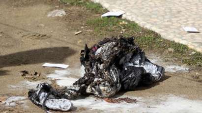 Трагедия в София! 49-годишен мъж се е самозапалил в Княжево