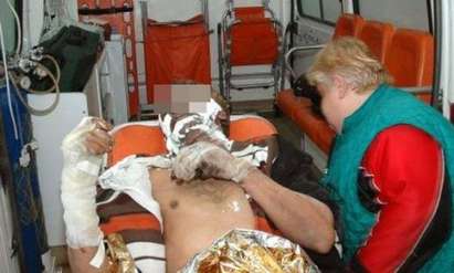 Работник от ВМЗ-Сопот падна във вана с опасни химикали