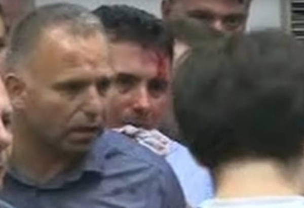 Напрежението в Македония ескалира: Окървавеният Зоран Заев изригна: Това бе опит за убийство!