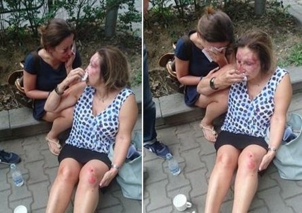 Битата в Борисовата градина е известeн нотариус! Маскираните нападатели я причакали с дъщеря й