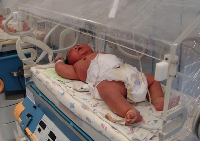 7-килограмово бебе се роди в бургаската болница