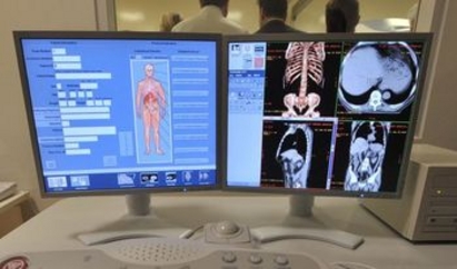 С ултрамодерен скенер се сдоби Онкологичният център в Бургас