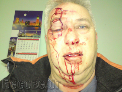 Цигани помляха журналиста Христо Луков пред петима полицаи