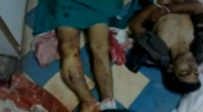 Най-малко 20 души са убити в Сирия, задържат лекари, за да не помагат на ранените (ВИДЕО 18+)