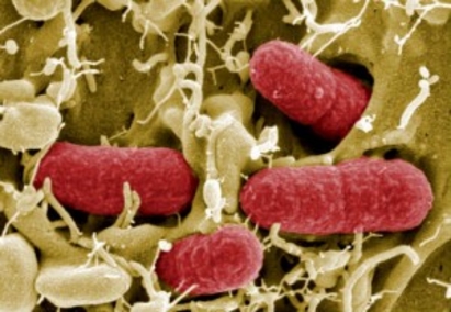 Зараза от E.coli в Япония