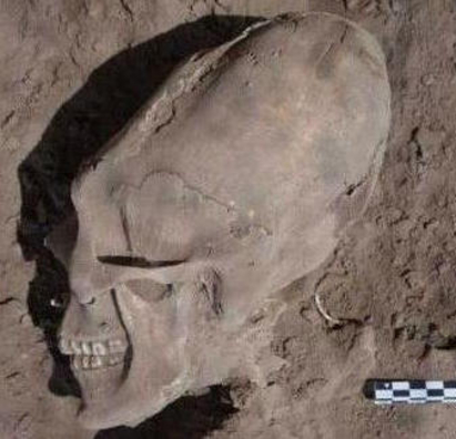 Откриха невероятен “извънземен” череп в гробище
