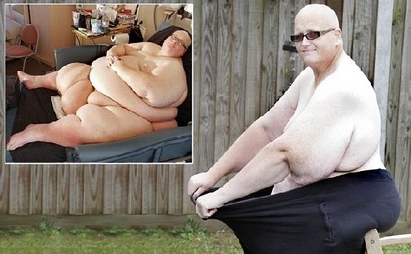 Най-дебелият мъж в света отслабна, тежи вече 152 кг