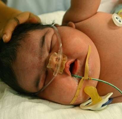 Германка роди по естествен път бебе с тегло 6,1 кг