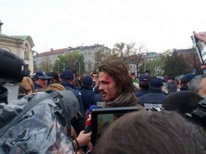 Полицията бие протестиращи в София, разбиха главата на студент