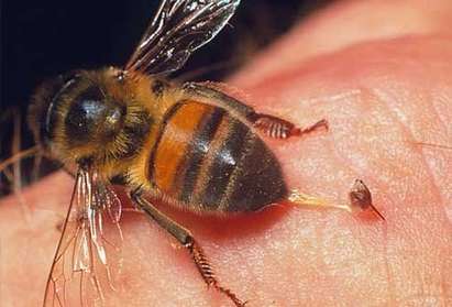 65-годишна бургазлийка издъхна за минути след ухапване от пчела