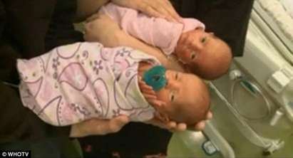 Британка роди близнаци без да знае, че е бременна
