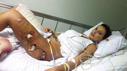 Миска показа шокиращи травми, причинени от пластична хирургия