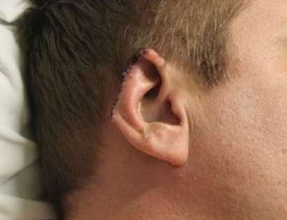 Мъж с отрязано ухо бере душа след бой в лозе