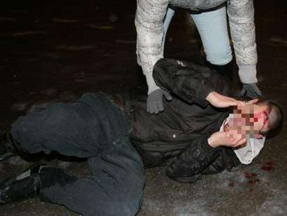 Кърваво меле в бургаска чалготека: Криминално проявени счупиха носа на 18-годишен младеж