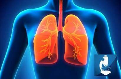 Внимание, туберкулоза върлува из Бургаско! Жълтата гостенка порази четирима за седмица