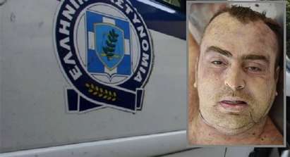 Ужас! Намериха българин, зверски убит и разфасован в Атина (СНИМКА 18+)