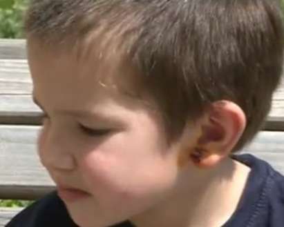 Питбул разкъса ухото на 5-годишно дете
