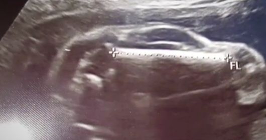 Млада жена в САЩ е „бременна с автомобил“