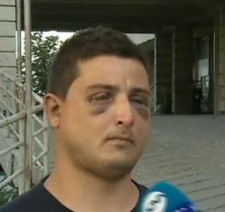 Пребитият с колове българин посочил престъпниците по имена, но полицаите ги разпитали и освободили