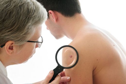 Успех: Учени разкриха причинителя на рак на кожата