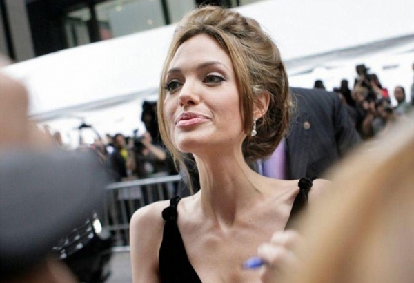 34-килограмовата Анджелина Джоли е на прага на смъртта