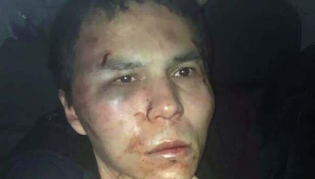 Вижте подутия от бой атентатор от "Рейна", заловен жив от турските спецчасти
