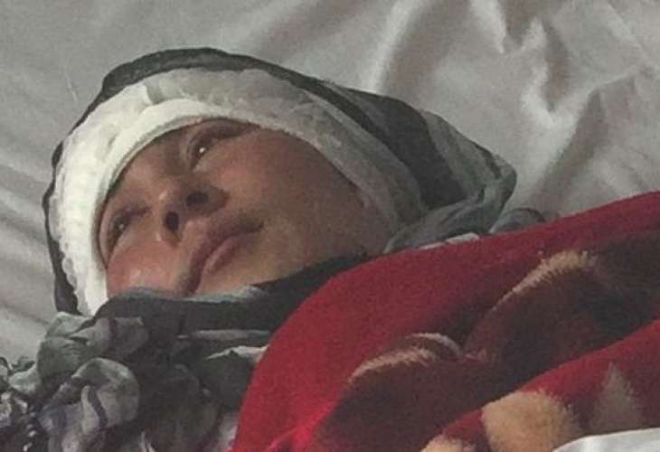 Ужасяващо! Афганистанец отряза двете уши на съпругата си бeз причина