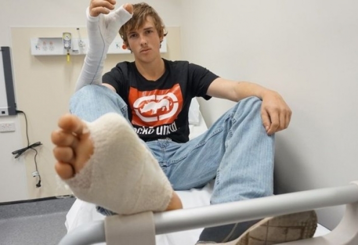 В Австралия присадиха на ръката на младеж пръст от крака му