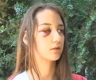 Изверг преби 13-годишно момиче в Несебър, психопатът набил и възрастна жена на спирка