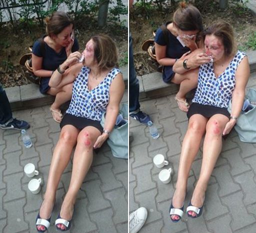 Издирват извергите, които пребиха майка и дъщеря в Борисовата градина (ВИДЕО)