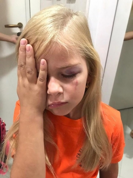 Кошмарен инцидент в молa съсипа първия учебен ден на руса принцеса - детето се появи посинено пред приятелите си! (СНИМКИ)