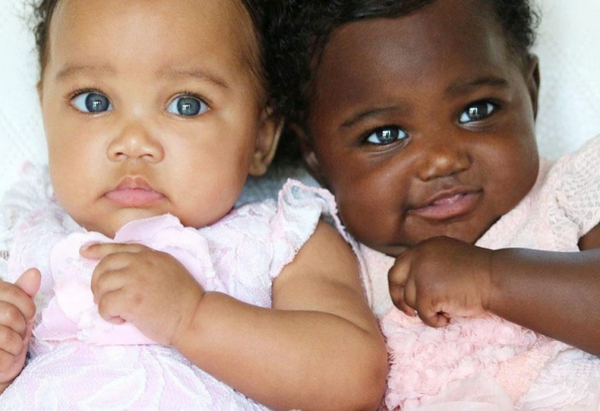Тези близначки са едва на седем месеца, но вече са световна знаменитост с хиляди фенове, причината е невероятна! (СНИМКИ)