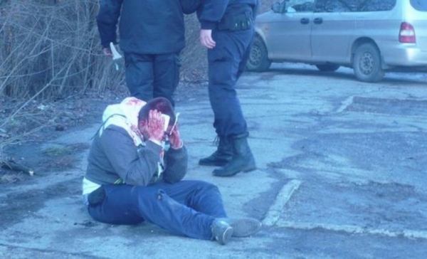 Агресия! Размазаха от бой мъж заради спор за паркомясто