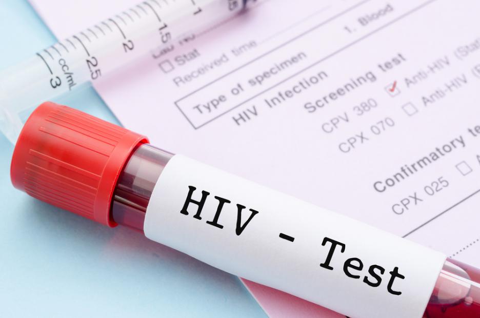 Има ли опасност? Втори случай на ХИВ позитивен в Бургас за последния месец