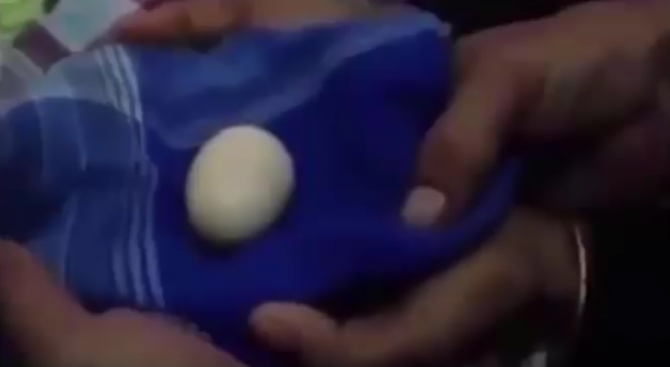 Момче от Индонезия твърди, че снася яйца (видео 18+)