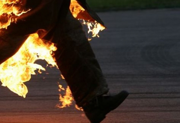 Мъж се самозапали, борят се за живота му