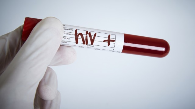 Пробив в борбата с ХИВ? Учени съобщиха за революционен напредък