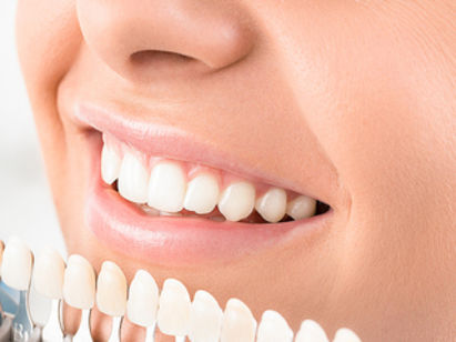 4 домашни рецепти за бели зъби