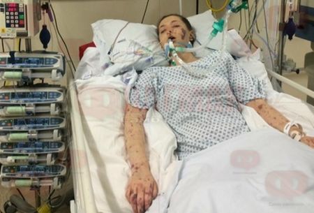 Огромна трагедия! 36-годишна жена почина след менингит в Бургас