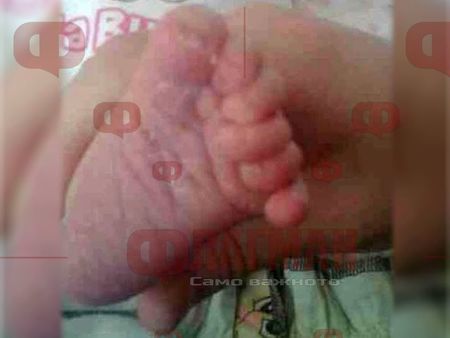 Само във Флагман! Бебче с шест пръста се роди в бургаска болница, родителите в шок