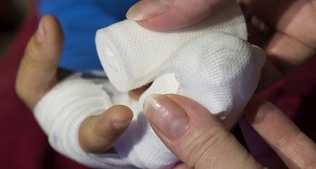 Шкаф отряза пръстите на момиче в детска градина