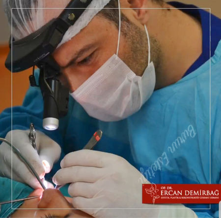 Топ пластичен хирург от Истанбул ще консултира безлатно в Бургас