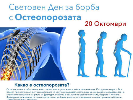 УМБАЛ-Бургас се включва в отбелязването на Световния ден за борба срещу остеопорозата