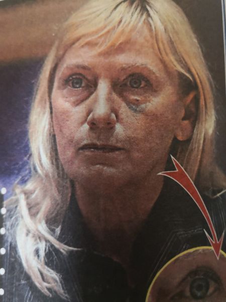 Защо Елена Йончева е с насинено око в Европарламента?