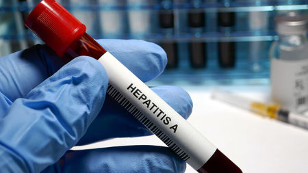 Ужас! Седем заболели от вирусен хепатит в Бургас за седмица